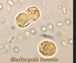 blastocystis hominis